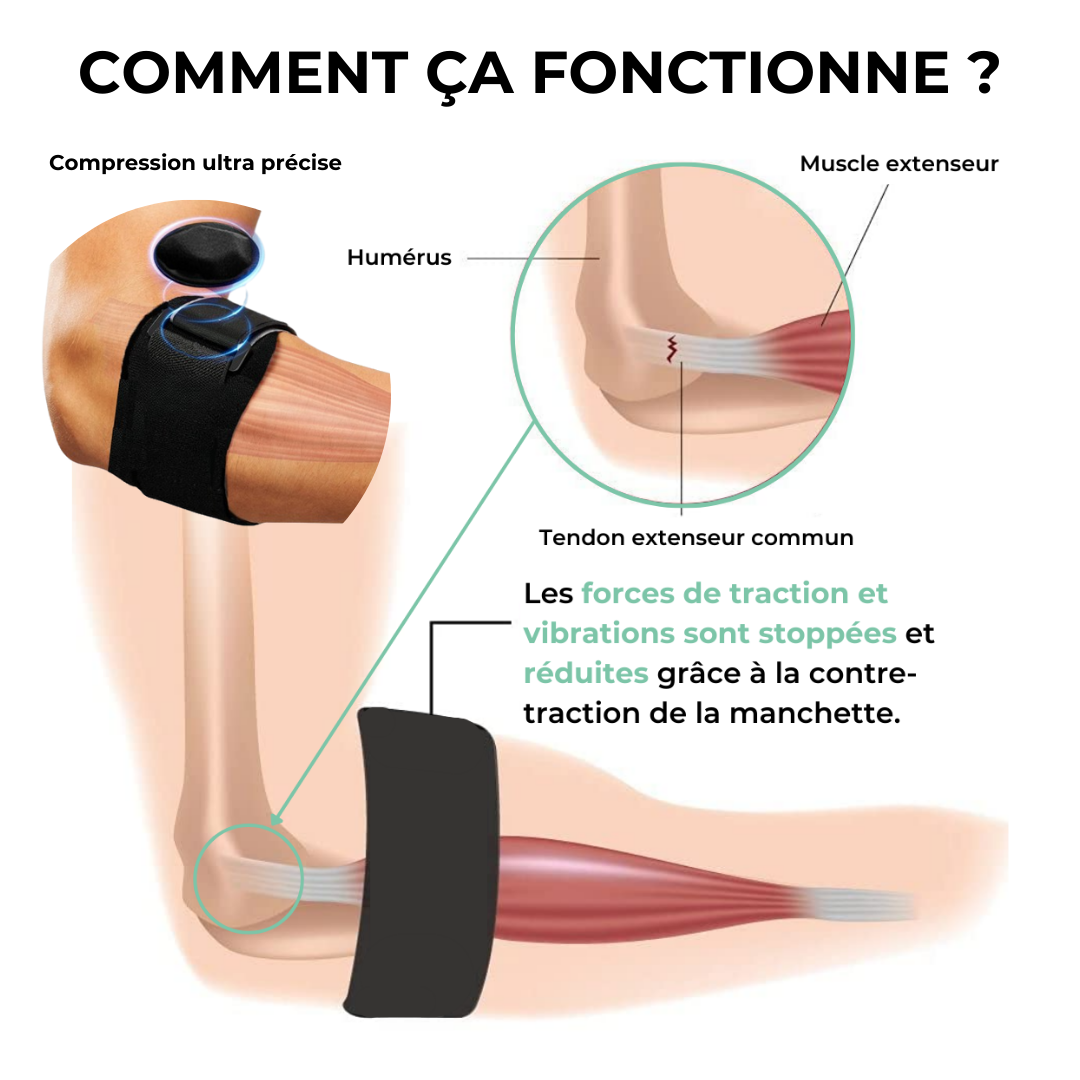SecureFlex - Vos coudes enfin sans douleurs
